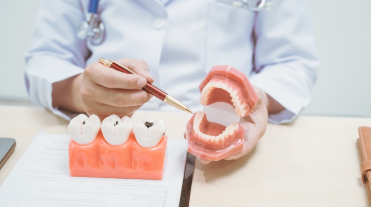 Dentist at Vistoso Dental Partners in Oro Valley, AZ explaining cavity prevention and treatment using tooth and jaw models.
